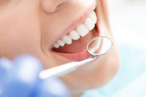 歯科用器具で口内を確認される女性